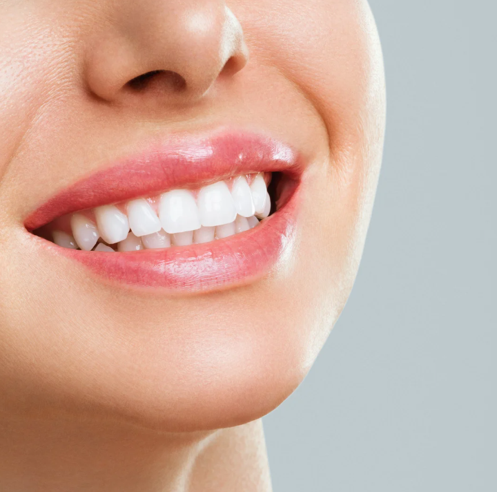 Fix chipped, cracked or gapped teeth with affordable dental bonding in Lilburn. Same-day results, natural look. Brilliance Family Dental. Call today!