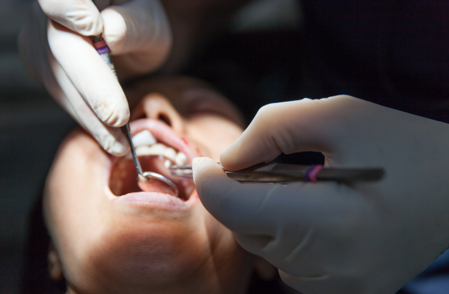 Dental emergency in Lilburn? We're here to help NOW! Brilliance Family Dental offers same-day care for tooth pain & broken teeth. Call immediately!