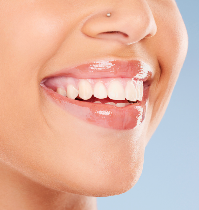 Ready for a smile makeover? Porcelain veneers in Lilburn transform your look fast! Brilliance Family Dental: natural, stunning results. Book today!
